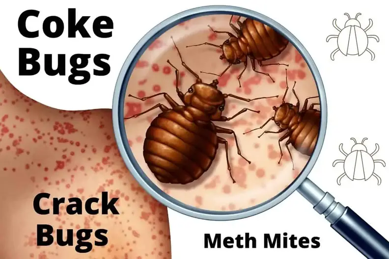 What Are Cocaine (Coke) Bugs or Crack Bugs? – Soberdogs Recovery